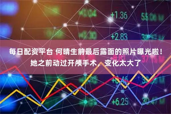 每日配资平台 何晴生前最后露面的照片曝光啦！她之前动过开颅手术，变化太大了